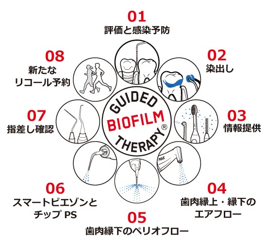 GBTによるクリーニング方法